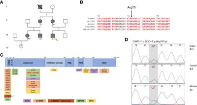 Hyper-IgE and Carcinoma in CADINS Disease